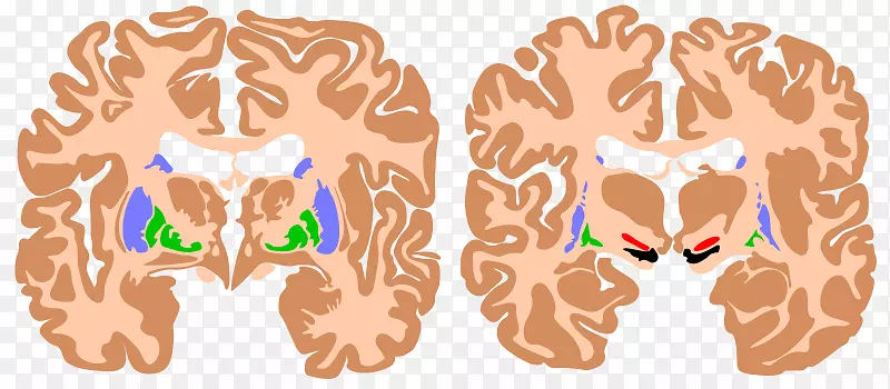 脑基底节AGY黑质神经节-脑