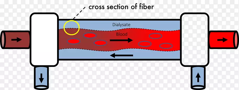 跨膜蛋白压血液透析-血液透析