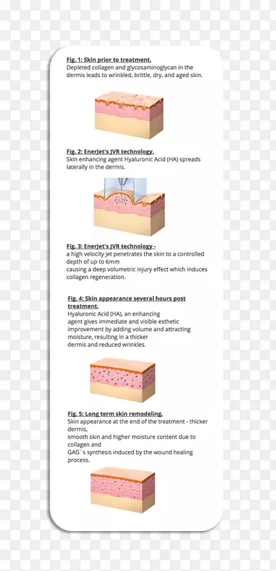 真皮瘢痕透明质酸皮肤愈合瘢痕