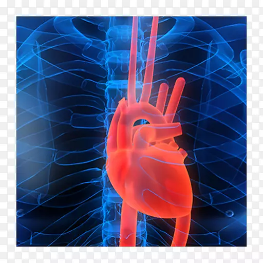 心血管疾病心脏病学心脏显像心脏急性心肌梗死-心脏