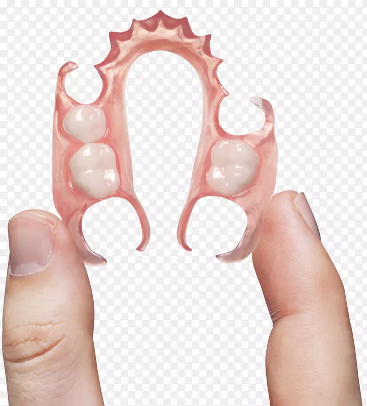 牙科实验室义齿可摘局部义齿