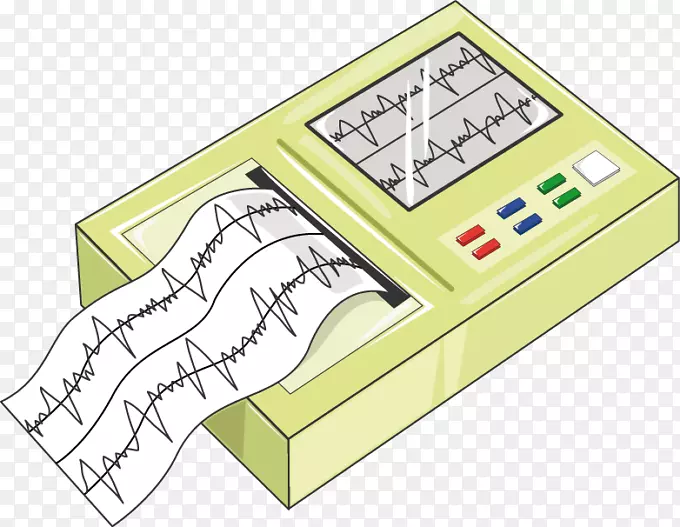 医疗设备心电图超声心脏应激反应试验药物.心电图监测