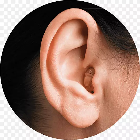 助听器宽耳管