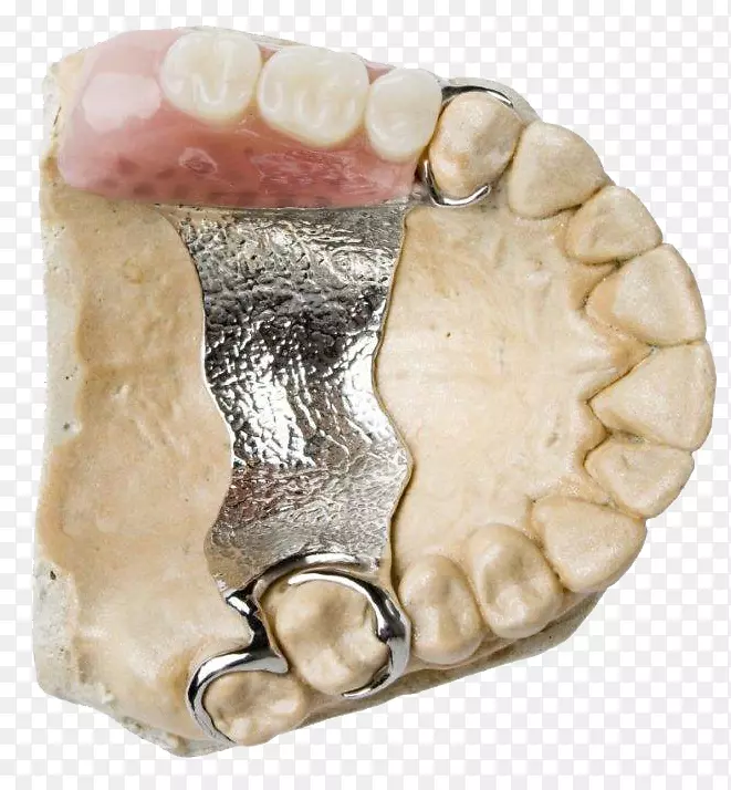 牙科假牙义齿.刻度和根刨