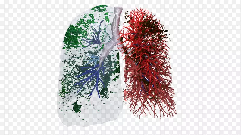 欧洲呼吸学会特发性肺纤维化呼吸道慢性阻塞性肺疾病肺-UNICAT催化剂技术