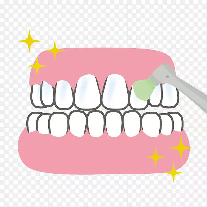 牙列假牙牙医歯科牙菌斑-牙齿清洁树枝