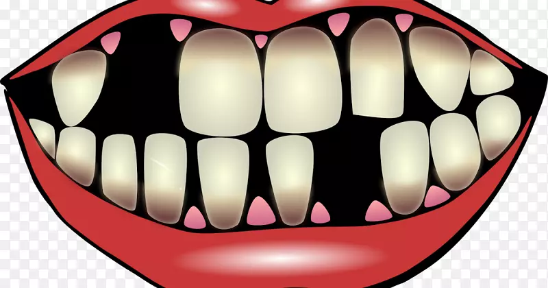 人类牙齿缺失剪贴画-微笑