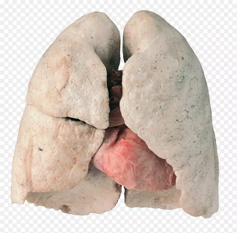 停止吸烟慢性阻塞性肺疾病-健康