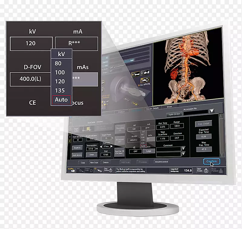 电脑监测器佳能医疗系统有限公司东芝电脑断层成像扫描器