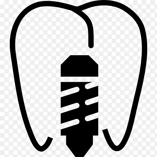 牙科种植体牙科歯科