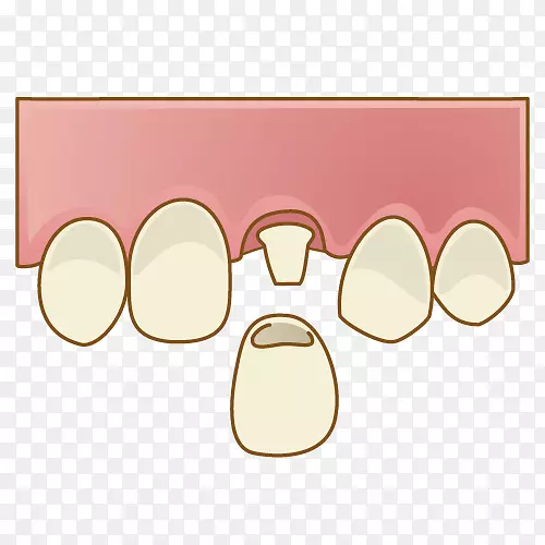 佐佐里牙科诊所牙科歯科歯冠継続歯-人