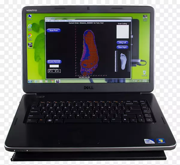 计算机硬件图像扫描器上网本个人计算机矫形器计算机实验室