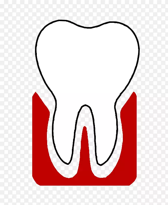 Mikros牙齿儿童牙周病
