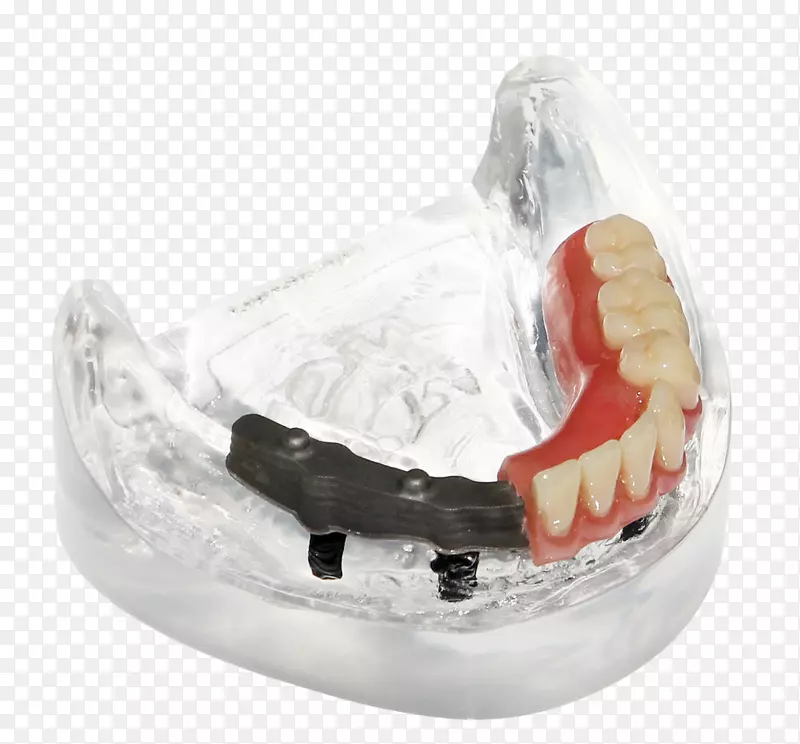 假牙、牙棒、牙科