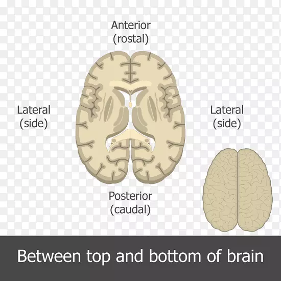 顶脑，下脑：对你认为大脑如何解释解剖冠状面脑的惊人洞察力。