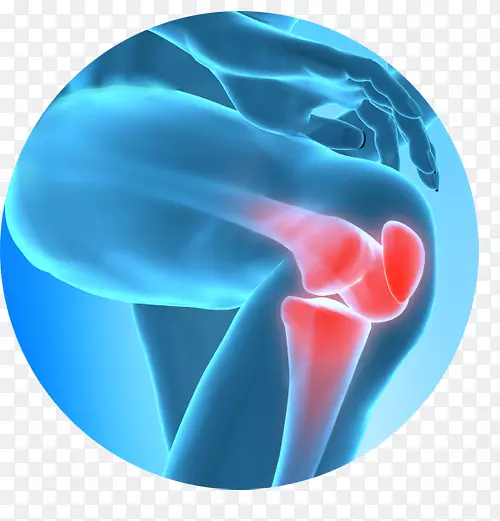 膝关节疼痛治疗疼痛管理关节疼痛手术感觉刺激疗法