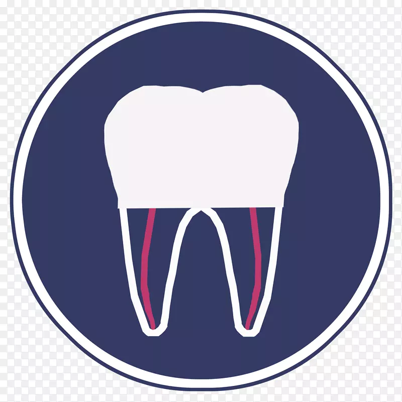 牙根管牙髓根管治疗牙冠