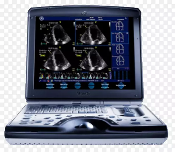 超声波SonoSite公司Ge医疗保健心脏病科医疗设备