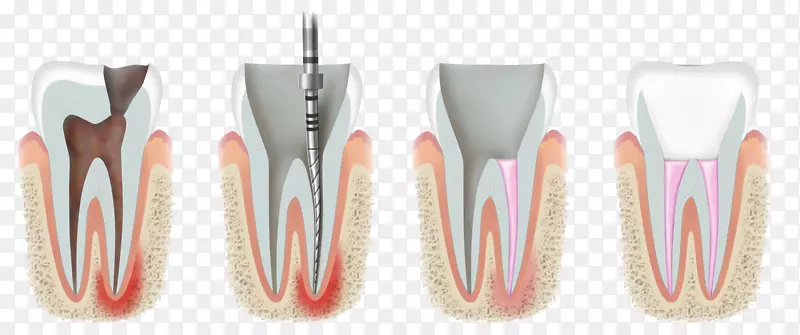 牙科治疗牙科