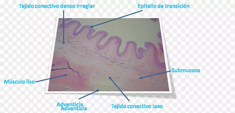 膀胱粘膜下固有层平滑肌组织光学显微镜