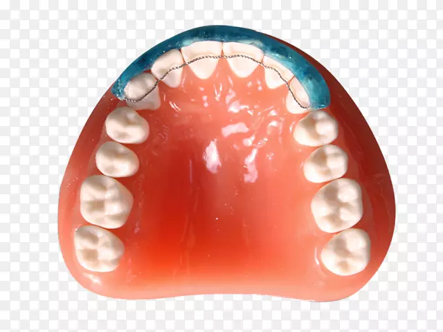 数字牙科诊断蜡