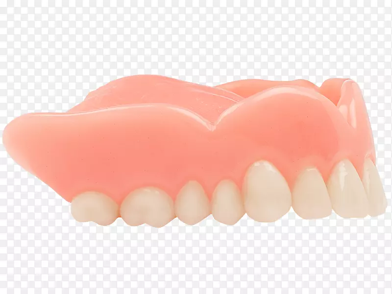 牙科牙龈可摘局部义齿