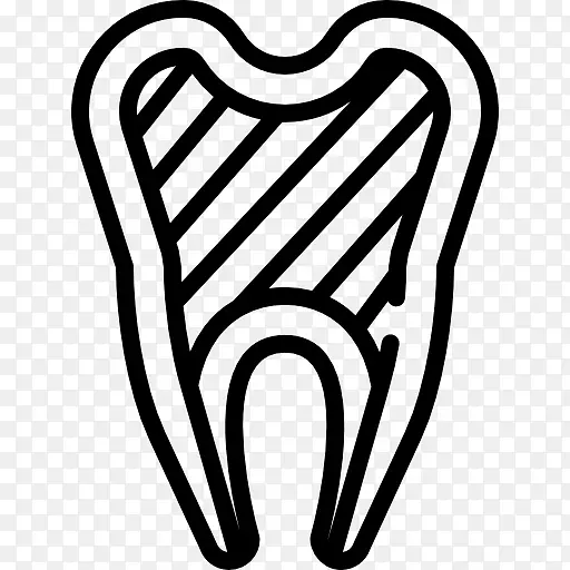 牙科牙髓治疗