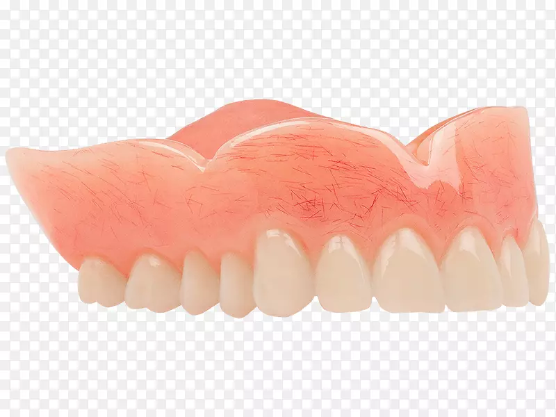 义齿、牙科、杨木、牙科丙烯酸树脂