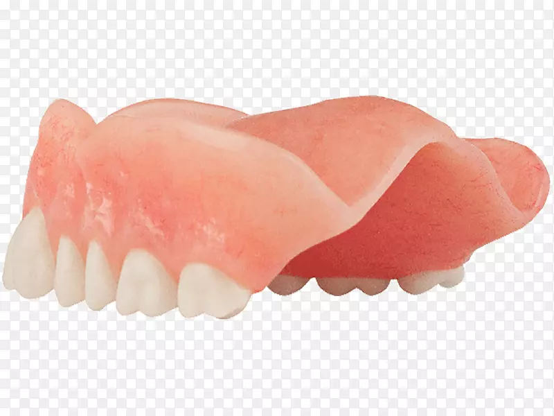 牙科全对4牙种植体