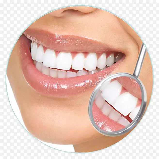 牙科美容牙种植体.牙本质