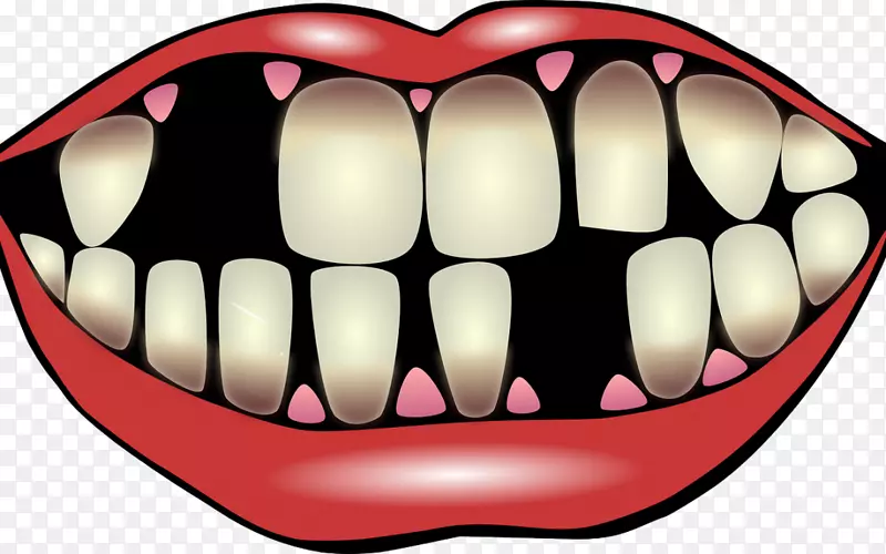 牙科种植牙-牙齿护理