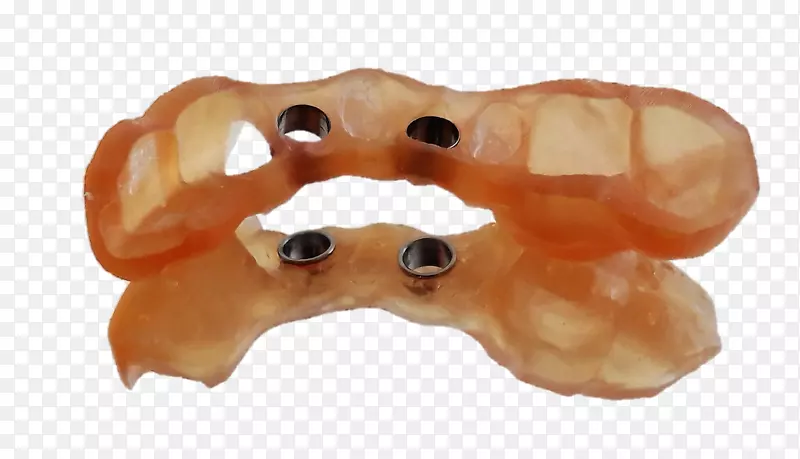 种植外科牙医3D打印