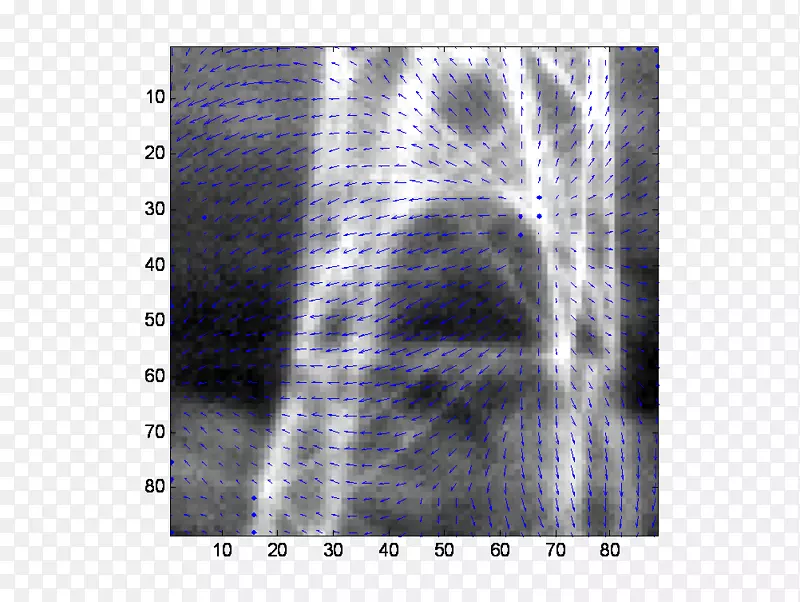 X射线放射学l ketieteellinen r ntgenkuvaus射线摄影-被动红外传感器