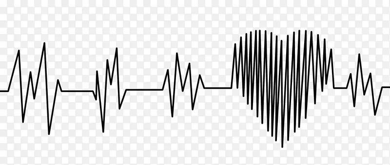 心电图心率监测脉搏心脏