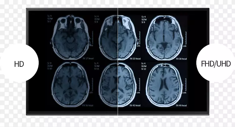 功能性磁共振成像计算机断层扫描创伤性脑损伤-医疗用品。