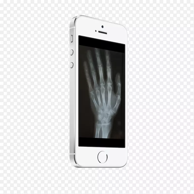 智能手机谷歌播放手机-x射线扫描仪