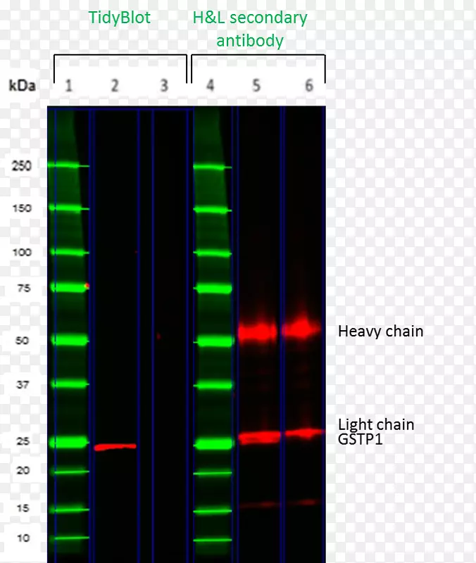 免疫球蛋白g蛋白印迹免疫球蛋白轻链重链-GSTP 1