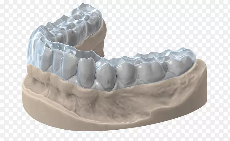 三维扫描仪牙齿计算机软件图像扫描仪三维打印咬合夹板