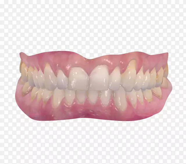 牙科影像扫描仪放射学牙弓