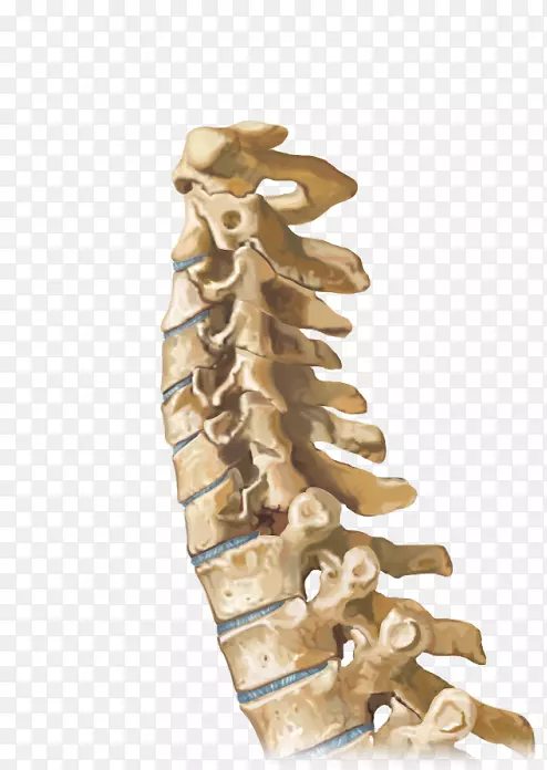 脊柱矢状面关节操作脊髓-颈椎