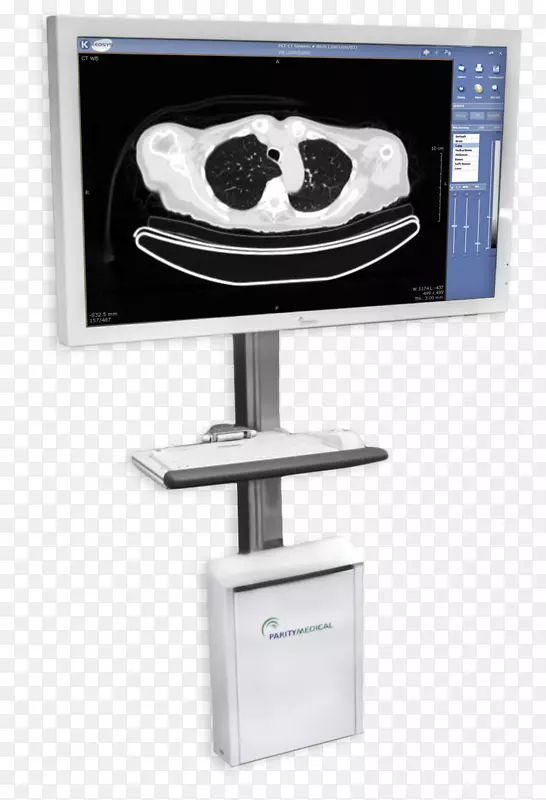 医学图片存档和通信系统放射学显示设备McKesson公司-公司