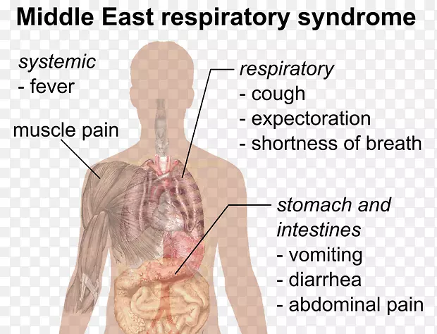 公共卫生中东呼吸系统综合症严重急性呼吸系统综合症大流行-健康