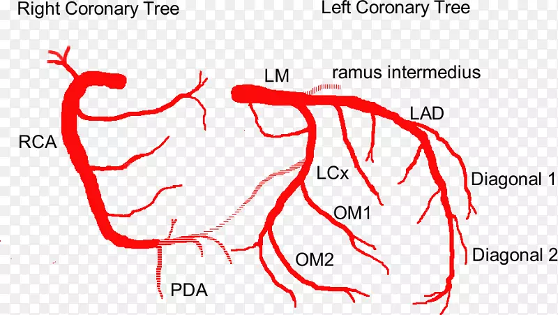 冠状动脉循环左冠状动脉前室间支解剖冠状动脉-心脏