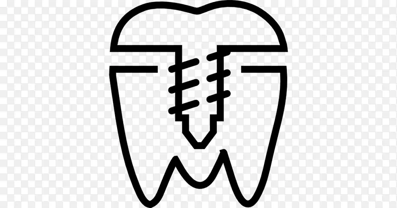 牙科种植义齿4面全口健康