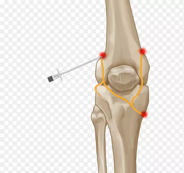 膝关节疼痛拇指关节髋关节-剑桥顾问