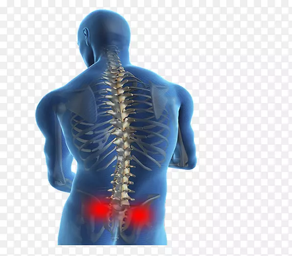 腰痛椎间盘突出症治疗人背侧脊柱