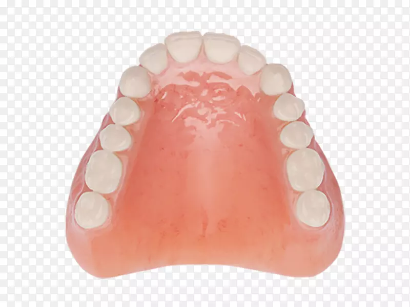 牙科可摘局部义齿