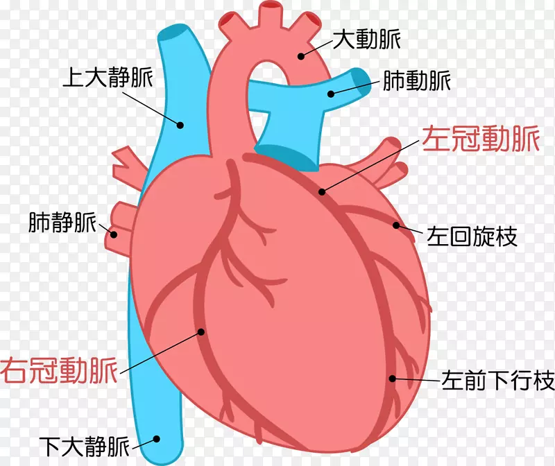 心脏急性心肌梗死心脏病-心脏