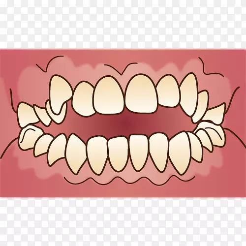 矯正歯科牙科支架牙科治疗牙列