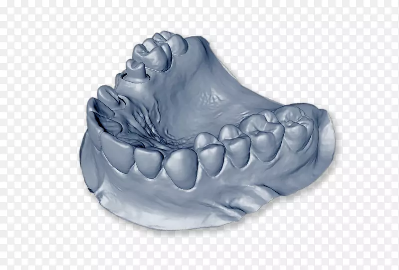 牙科实验室假牙牙科技术人员牙科模型